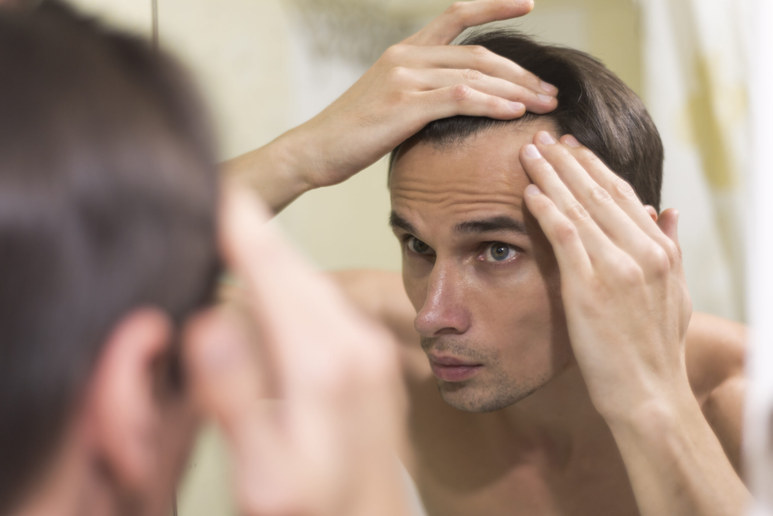 Forehead Hair Loss